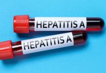 Hepatitis A: tras casi dos décadas sin trasplantes pediátricos, los adultos jóvenes concentran la mayoría de los casos