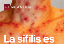 Sífilis: los diagnósticos en mujeres aumentaron 26% en los centros de AHF Argentina